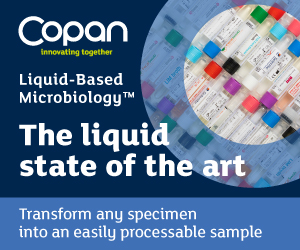 Copan Liquid Based Microbiology transforms challenging specimens into an easily processable sample