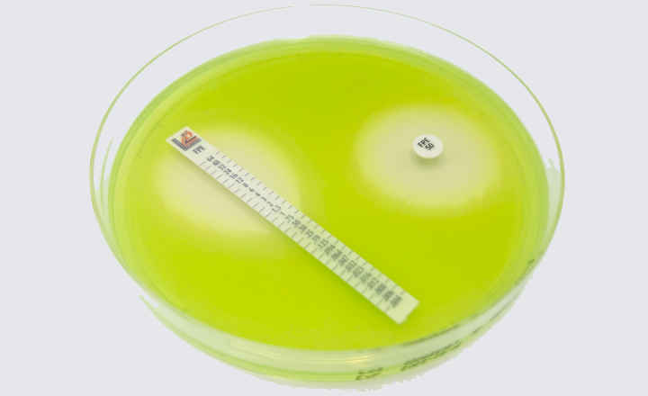 IVDR Compliance Achieved for Cefepime-enmetazobactam Testing Solutions