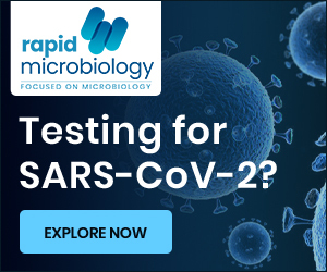 SARS-CoV-2 - PCR Antigen Kits Buyers Guide