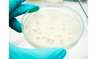 Optimized Plating of Bacterial and Yeast Cells on Standard Agar Plates