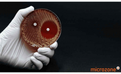 Petri dish showing antibiotic resistance